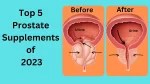 Top 5 Prostate Supplements of 2023