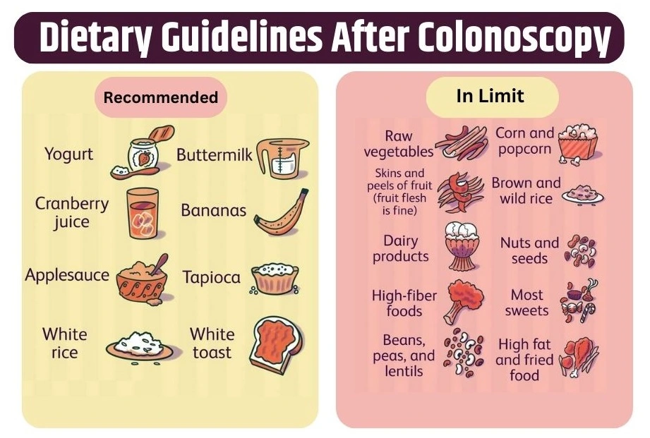 What To Eat After Colonoscopy: A Guide To A Speedy Recovery