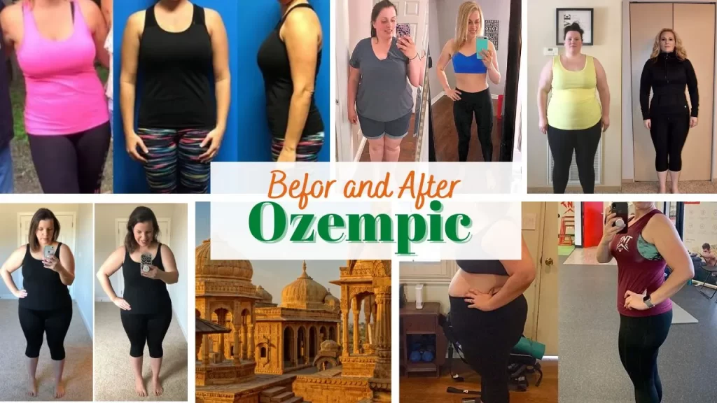 Ozempic Weight Loss Reviews 2024 - Before/After, Side Effect